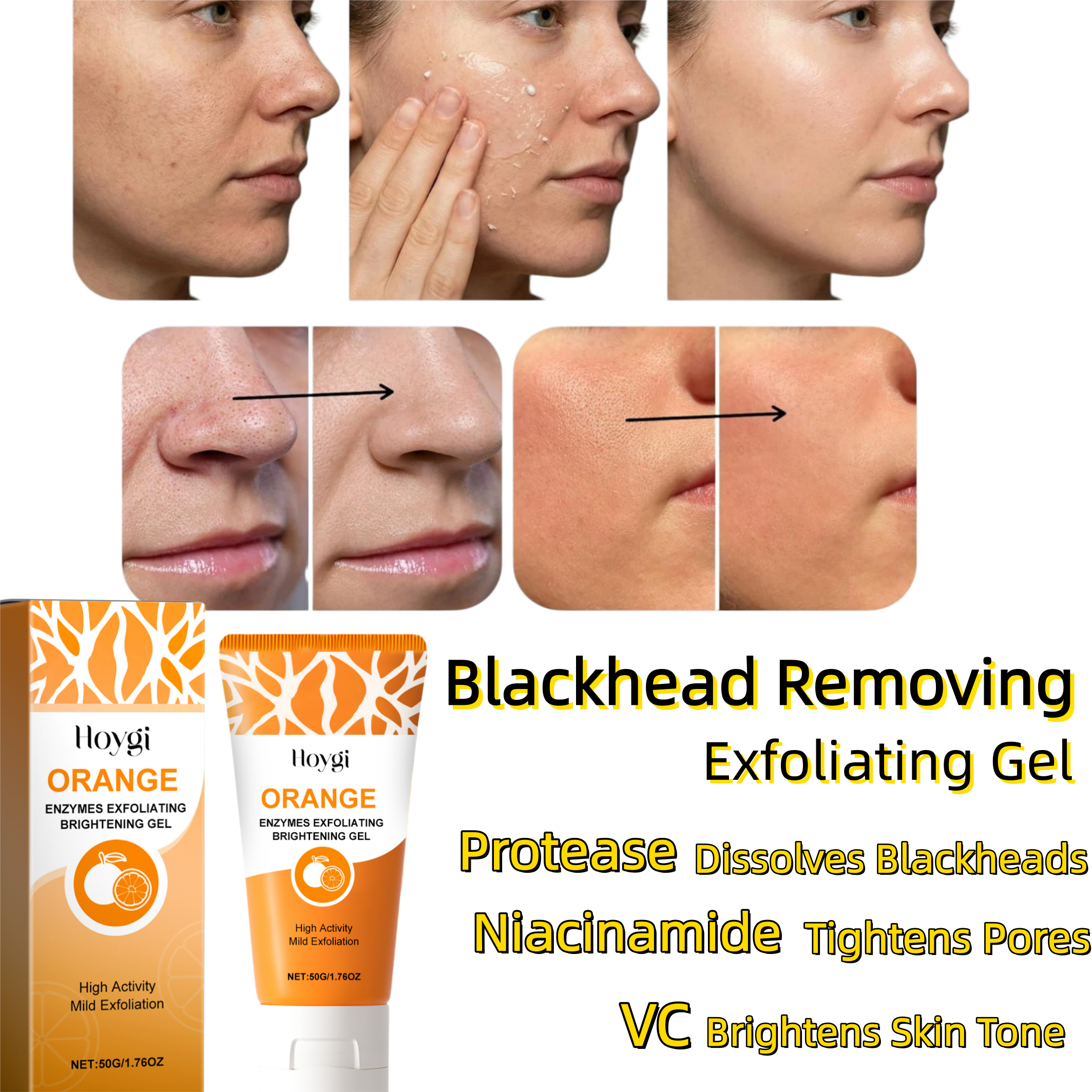 Aha Bha Exfoliant - Blackhead Clearing Exfoliating Gel,Blackhead Removal&Full Face