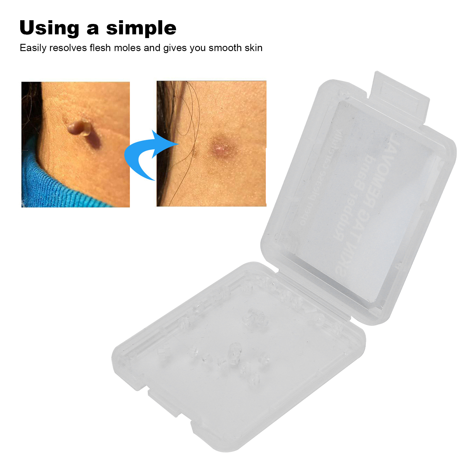 30Pcs Painless Skin Tag Remova - Skincare Ingredients Checker 리뷰 및 가격