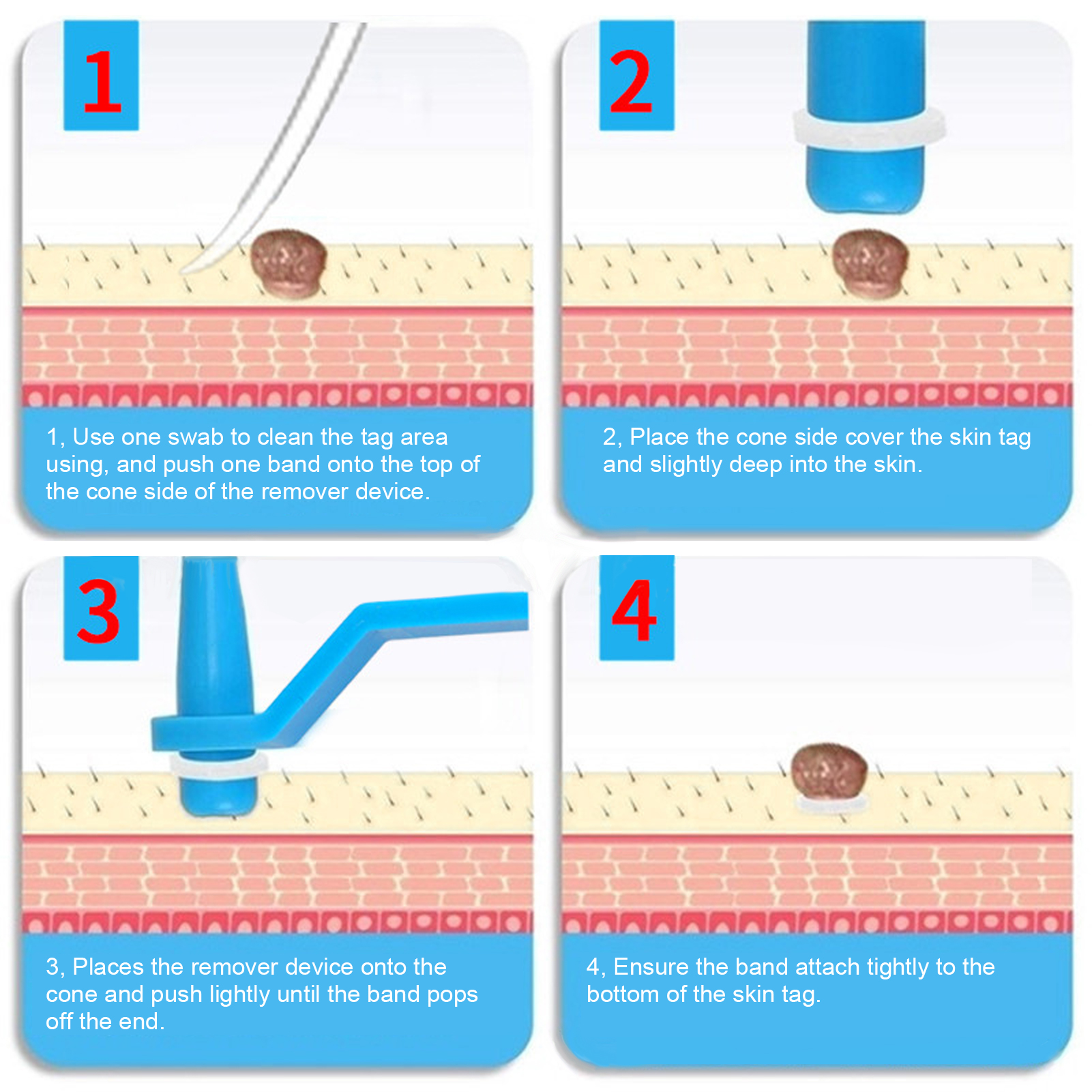 30Pcs Painless Skin Tag Remova - Skincare Ingredients Checker 리뷰 및 가격