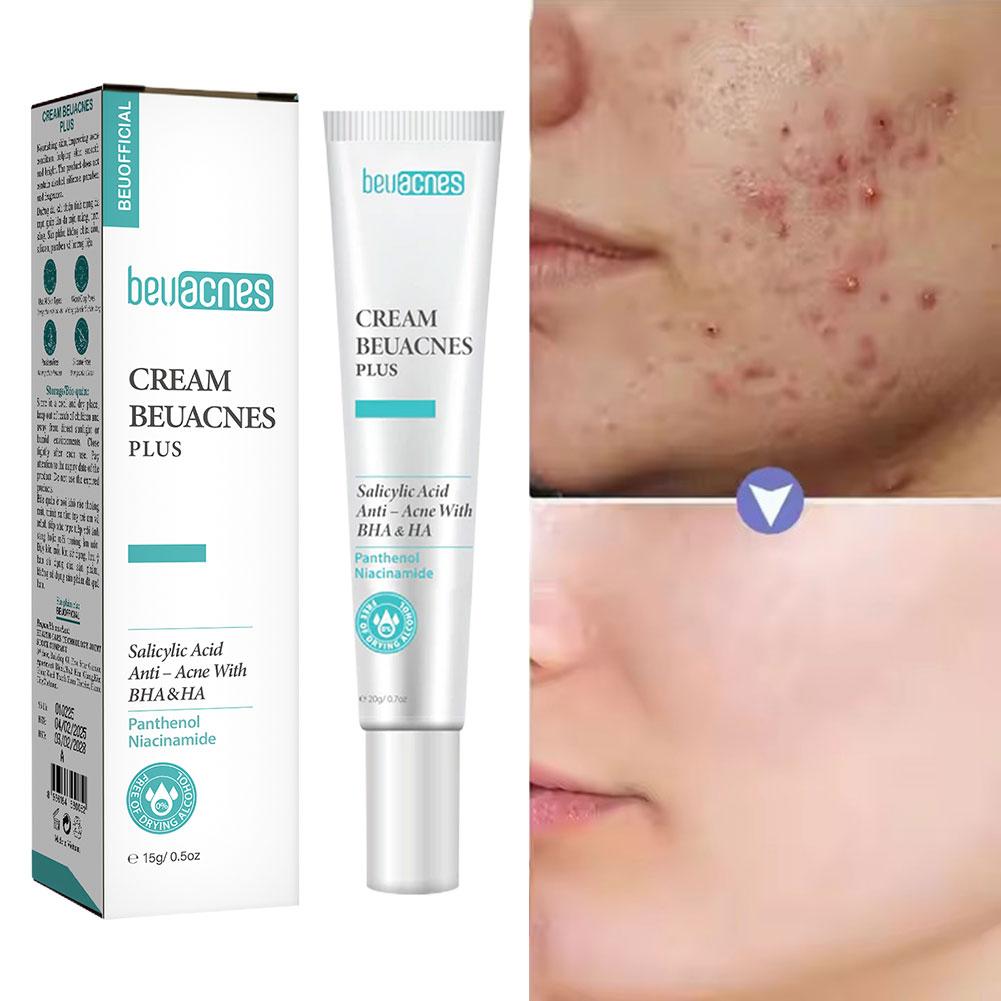 New 20g Niacinamide Acne Gel A - Skincare Niacinamide 리뷰 및 가격