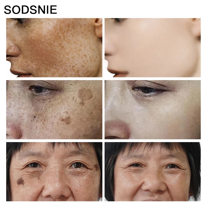 Dark Spot Remover Vitamin C Wh - Skincare Niacinamide 리뷰 및 가격