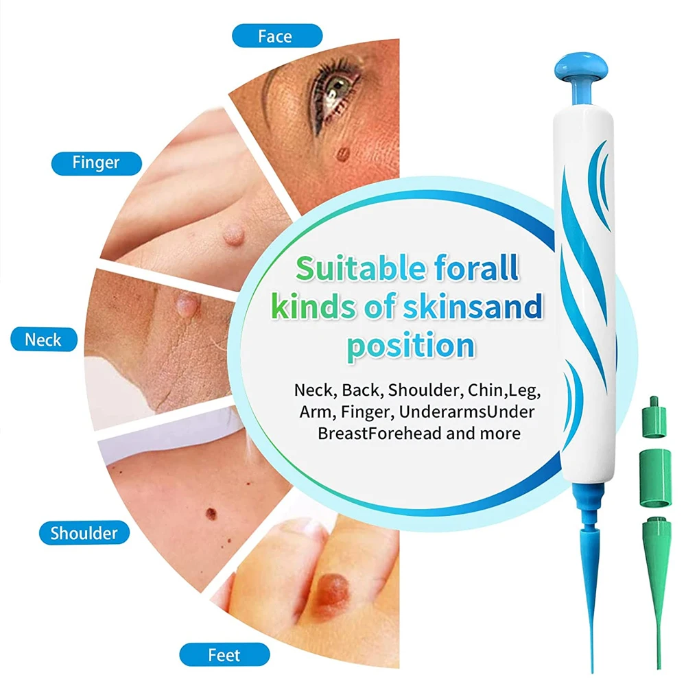 2 IN 1 Auto Micro Skin Tag Rem - Skincare Ingredients Checker 리뷰 및 가격