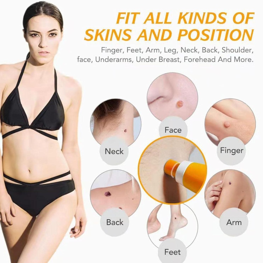 Auto Skin Tag Removal Kit For  - Skincare Ingredients Checker 리뷰 및 가격