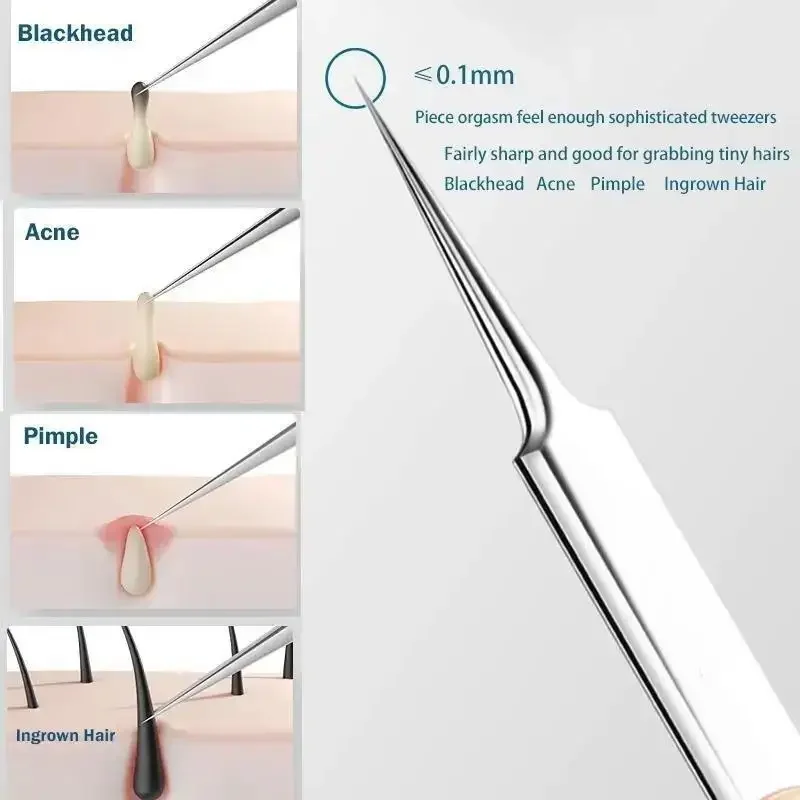 11Pcs/Set Acne Needle Blackhea - Skincare Ingredients Checker 리뷰 및 가격