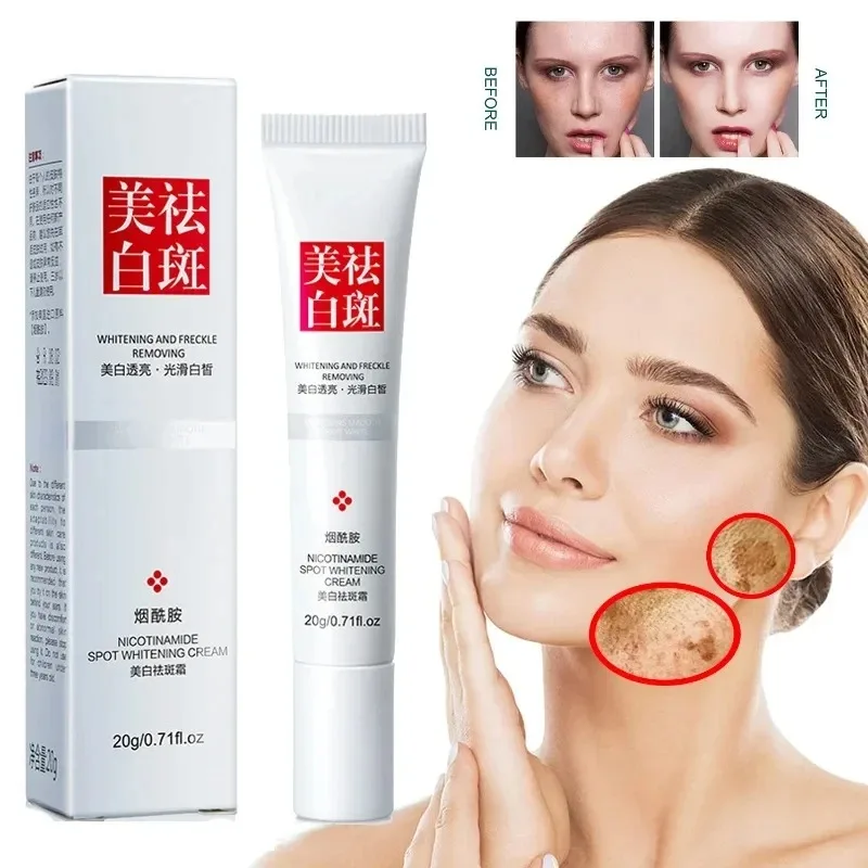 Fades Freckle Dark Spots Face  - Skincare Niacinamide 리뷰 및 가격