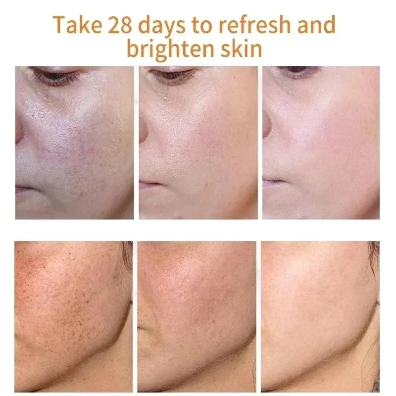 Fades Freckle Dark Spots Face  - Skincare Niacinamide 리뷰 및 가격