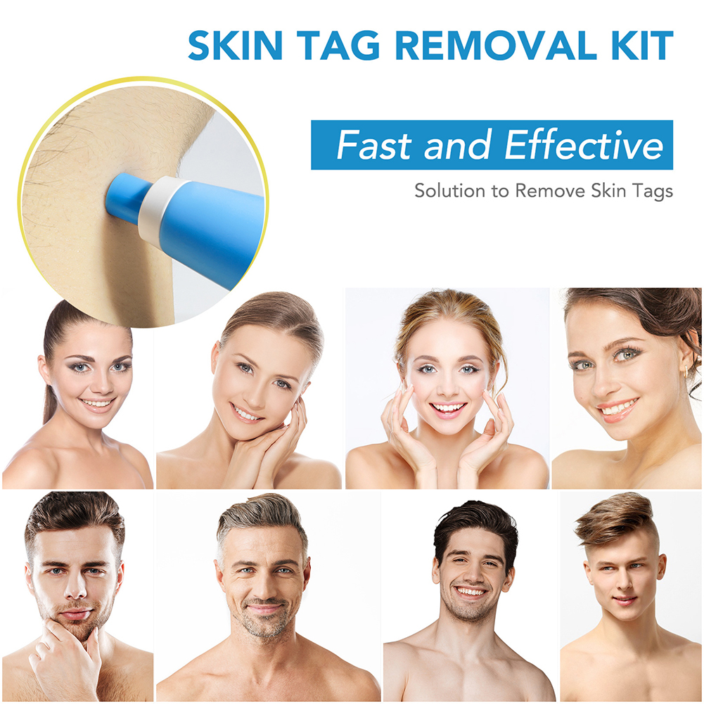 2-IN-1 Auto Skin Tag Removal K - Skincare Ingredients Checker 리뷰 및 가격