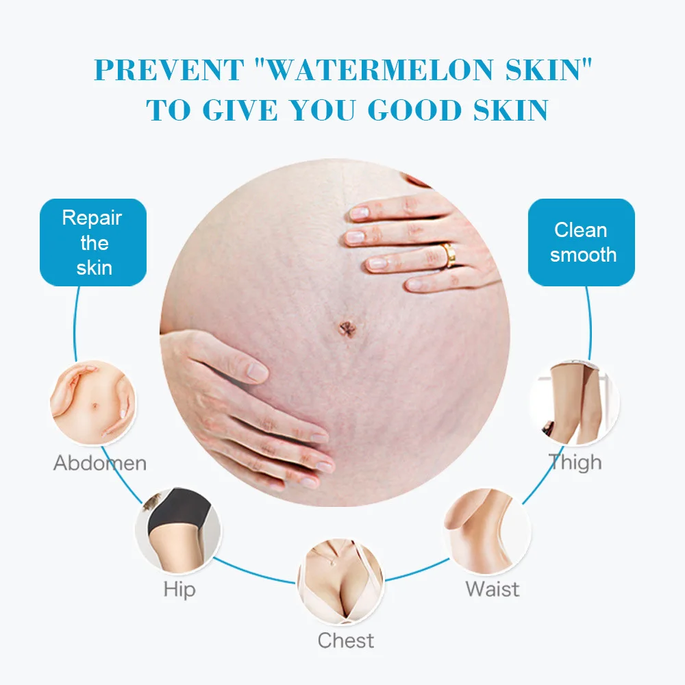 Snail Removes Stretch Mark Cre - Snail Cream Gel 리뷰 및 가격